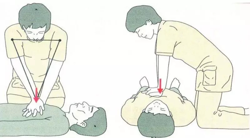 心脏按压