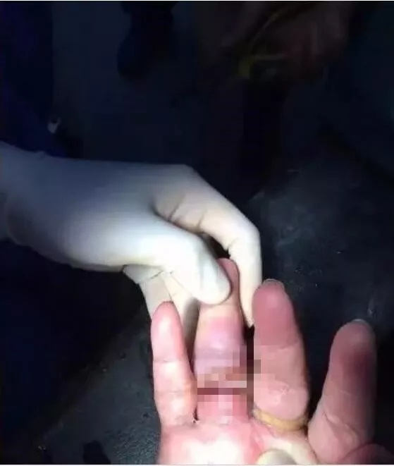 消防员处理的那些奇葩事故